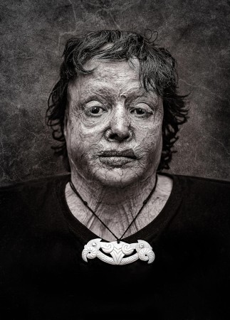 Black and white portrait of a Maori woman who has suffered burns to her face.