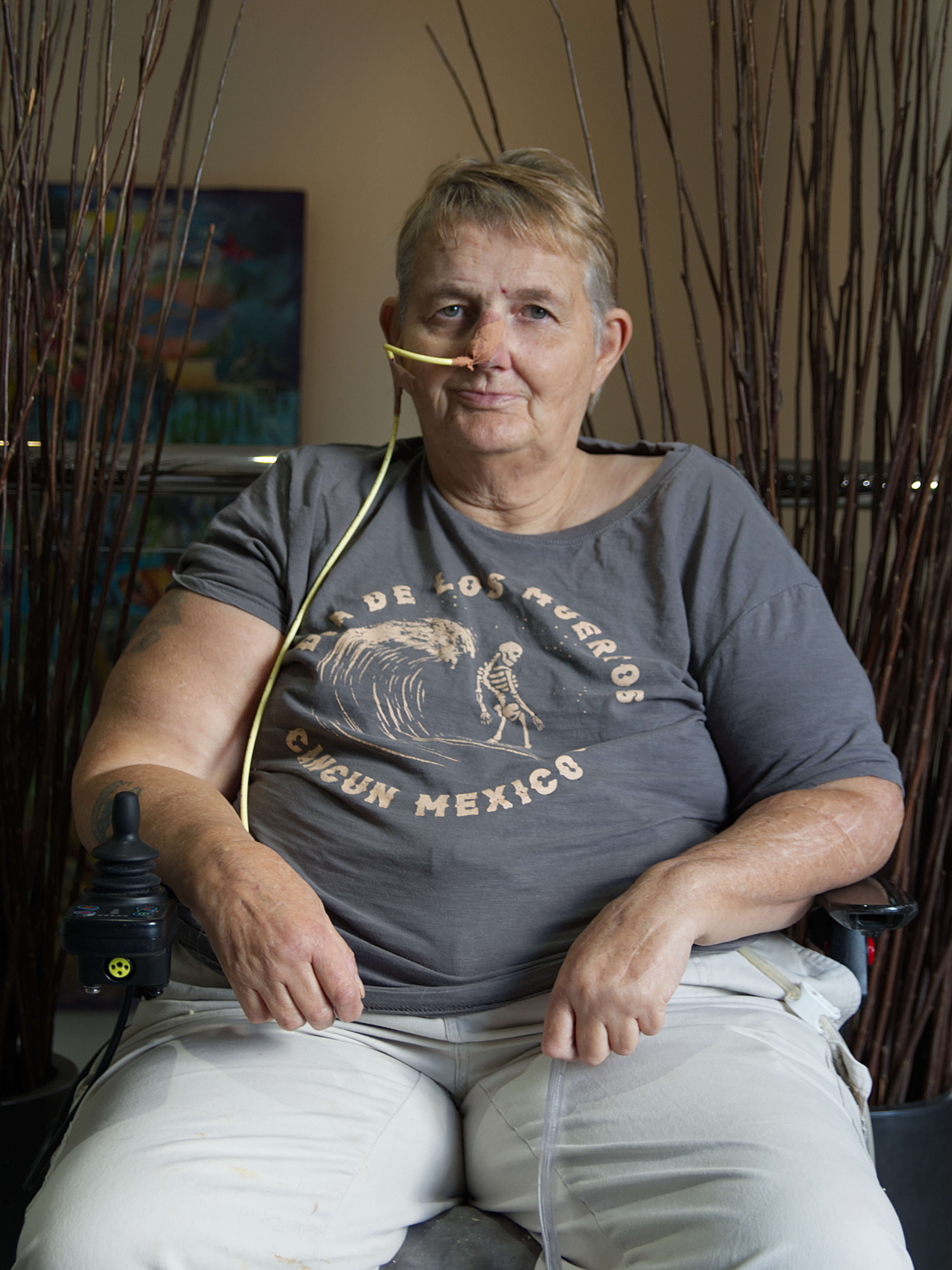 photographic portrait of a Rhonda Trivett, she is sitting in a wheelchair with a feeding tube in her nose, she has short brown hair and wearing a grey t-shirt