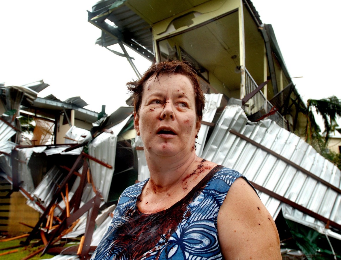  Kate Charleston stands injured outside her destroyed Innisfail home after Cyclone Larry, 2006.