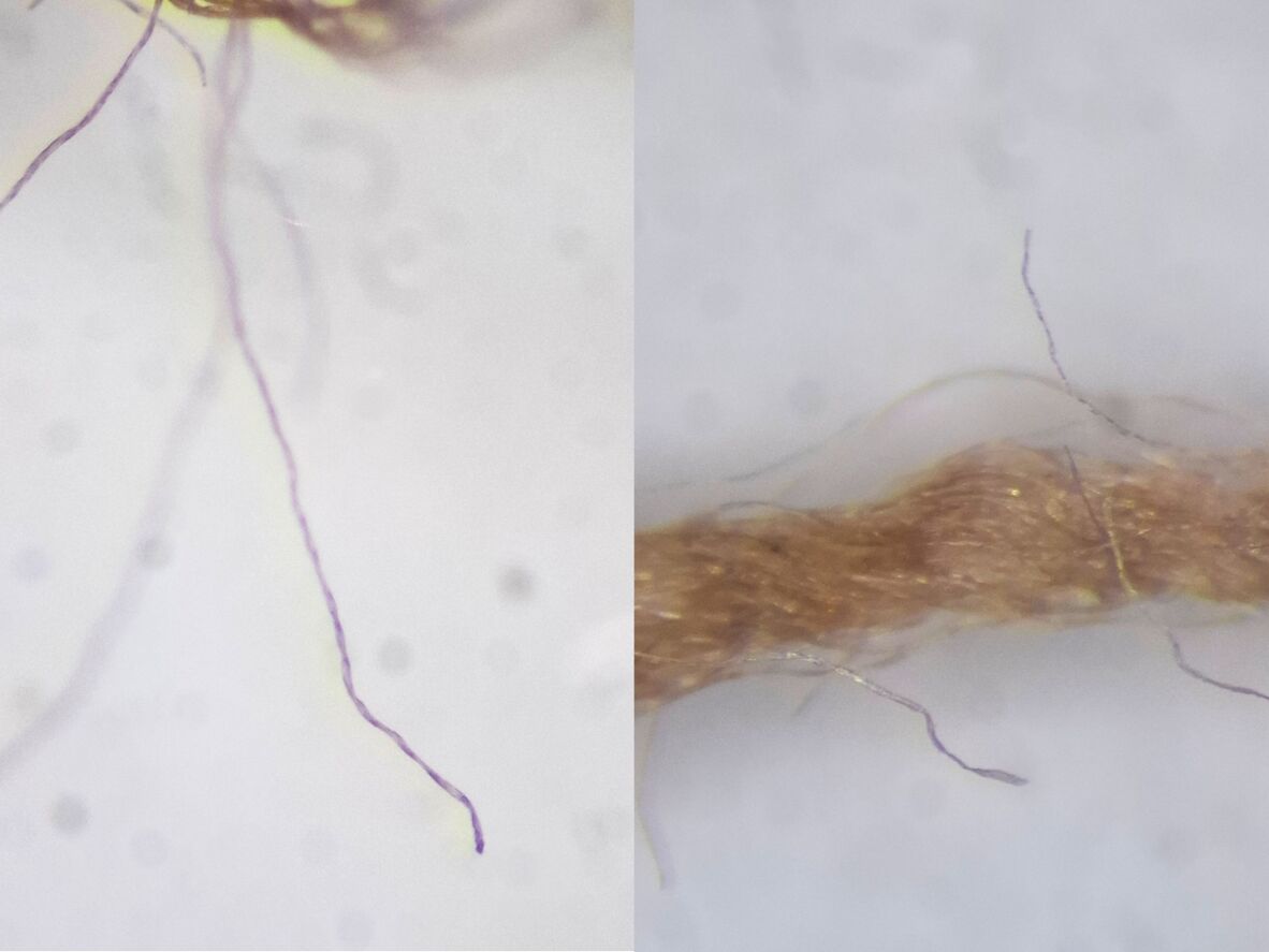Two images of fibres magnified under a microscope